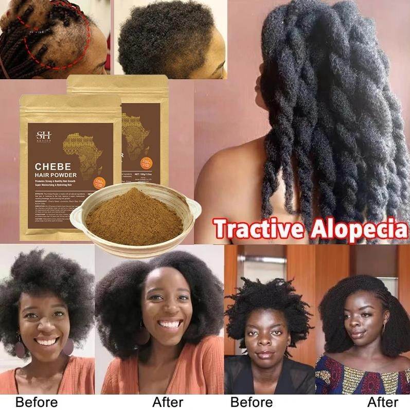 Poudre de chebe pour la croissance des cheveux, traitement rapide contre la perte de cheveux - Style & confort