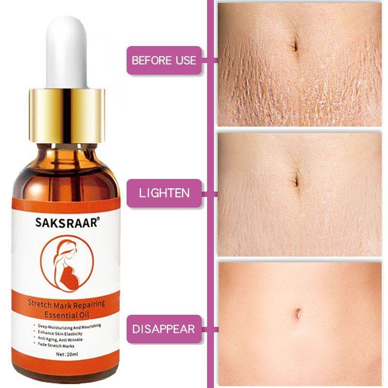 Crème de soin aux huiles essentielles anti-vergetures - Style & confort